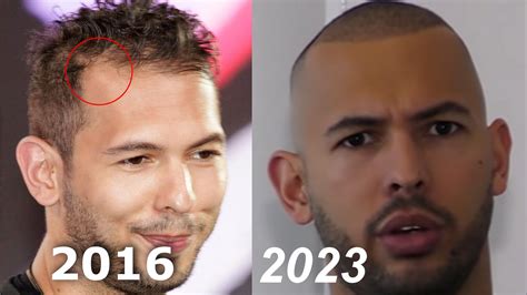 Andrew tate haircut - Feb 15, 2023 · According to sources, Tate also had a hair transplant in 2019 to fix his thinning hair and receding hairline. For this, he underwent a procedure known as Follicular Unit Extraction (FUE). Andrew Tate’s journey – from the top to the bottom. Andrew Tate has come a long way from when he first came on the scene. 